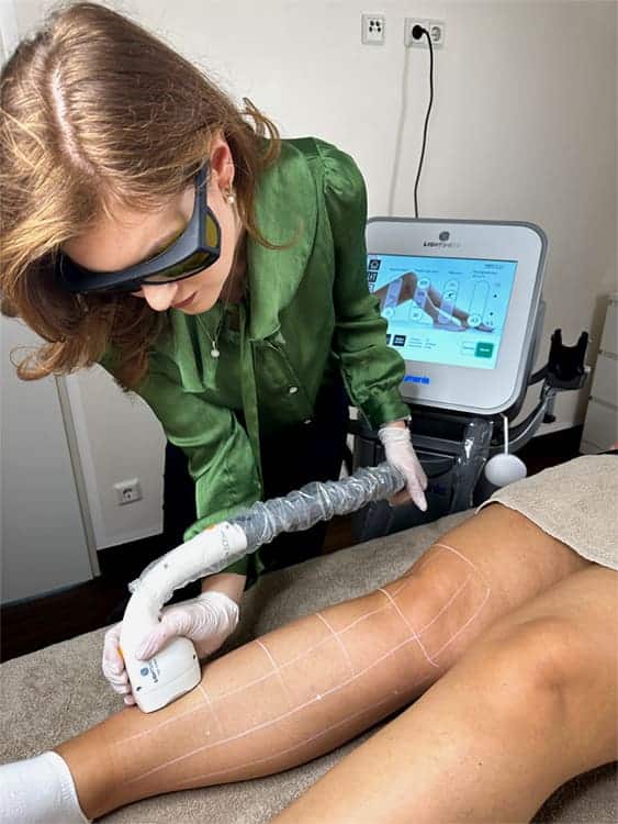 Laser Haarentfernung an Beinen mit dem Diodenlaser im Kosmetikstudio